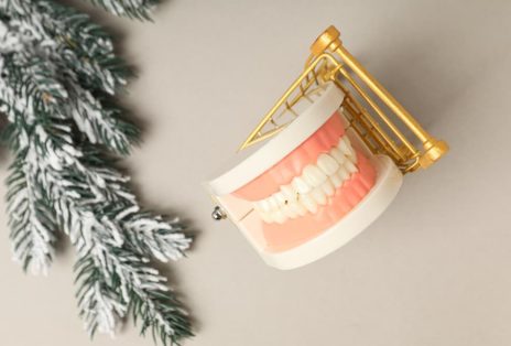 Long-Term Oral Health Benefits of Choosing All-on-4 in the New Year Image