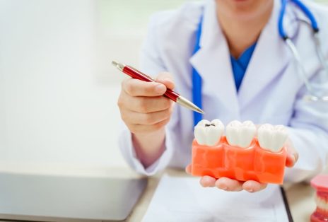 How Early Detection at Dentexcel Can Save Your Teeth and Your Wallet Image