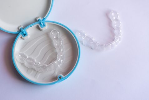 What It’s Like Living with Invisalign Aligners